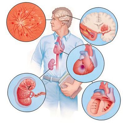 Cardiol previene lo sviluppo di comorbidità